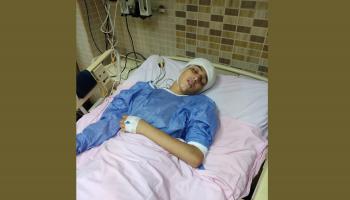 الطفل المصاب