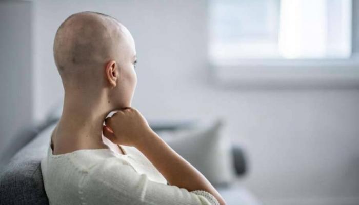 تساقط الشعر من التأثيرات الجانبية لعلاجات مرض السرطان - أرشيفية