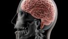 Peut-on prévenir un accident vasculaire cérébral ? Adopter de saines habitudes de vie