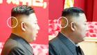 ضمادة على رأس زعيم كوريا الشمالية تثير حيرة العالم