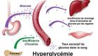 Les symptômes de l’hyperglycémie