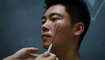 عمليات التجميل تستهوي الرجال في الصين