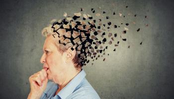 مرض ألزهايمر هو الشكل الأكثر شيوعاً للخرف
