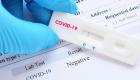 ظهور متحور جديد لفيروس كورونا في فرنسا.. يضم 46 طفرة