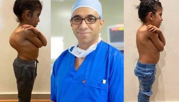 هاني عبدالجواد يتوسط صورة تبين الفرق بين حالة طفلة قبل وبعد العملية 