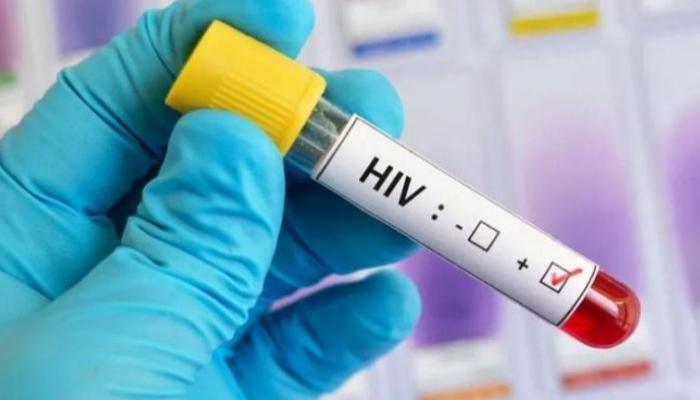Hiv من الامراض المعدية التي يسببها فيروسات