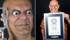 یک مرد برزیلی با رکورد «بزرگترین کره چشم» وارد گینس شد (+تصاویر)