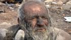 'Dünyanın en kirli adamı' hayatını kaybetti