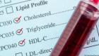 المكملات الغذائية وعلاج الكوليسترول.. دراسة تفضح الوهم