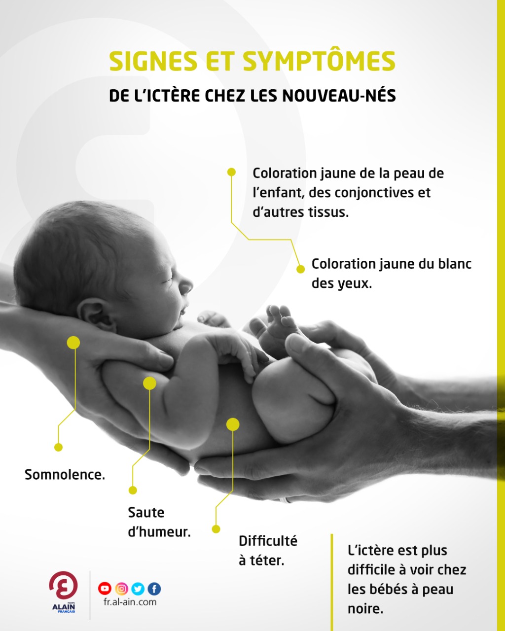 Signes et symptômes de l'ictère chez les nouveau-nés