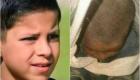کودک افغان گیرمانده در چاه، جان باخت