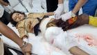 جرائم الحوثي.. مقتل امرأة وجنينها بتعز وإصابة 3 أطفال في مأرب