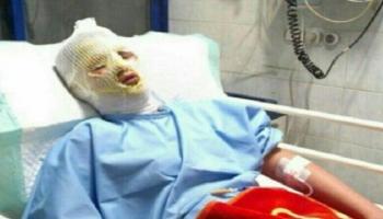 أحد المصابين في ليلة الأربعاء الأخير