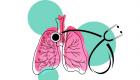 Tuberculose : Symptômes et facteurs de risque