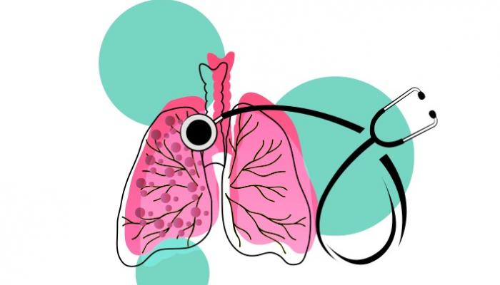 Tuberculose : Symptômes et facteurs de risque
