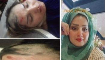 الفرطوسي قبل وبعد تعرضها للتعنيف من قبل أشقائها