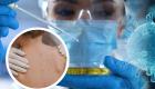 Variole du singe ou monkeypox : un premier cas confirmé en France