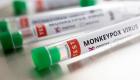 فرنسا تسجل 51 إصابة بجدري القردة