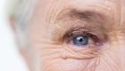 الضمور البقعي مرتبط بالعمى.. 8 نصائح للوقاية