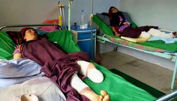 ضحايا من النساء بنيران مليشيات الحوثي - أرشيفية