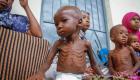 المجاعة تهدد 7 ملايين صومالي.. وبابا الفاتيكان يناشد العالم دعمهم