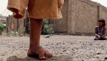 الألغام تشوه أطفال اليمن- أرشيفية