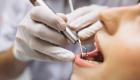 مرضى الحساسية وعلاج الأسنان.. توصية تجنب المخاطر