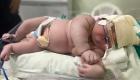 تولد نوزاد ۷ کیلویی در برزیل! (+عکس)