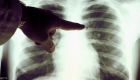 آیا «بیماری تنفسی جدیدی» در چین ظهور کرده است؟