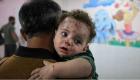 انتشار الجدري في غزة.. هل يتحول إلى وباء؟