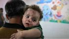 Gazze'de salgın endişesi: Çiçek hastalığı yayılıyor 