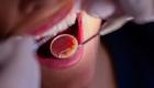 أسباب «صادمة» وراء سرطان تجويف الفم.. ما علاقة المخدرات؟