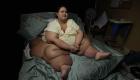 چاق‌ترین زن دنیا 360 کیلوگرم از وزنش کم کرد! (+تصویر)