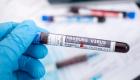 إسبانيا ترصد أول إصابة مشتبه بها بفيروس ماربورغ