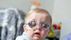 موردی نادر و عجیب؛ تولد نوزادی با چشم‌های متورم و نابینا! (+تصاویر)