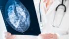 مركب حيوي يوقف انتشار سرطان الثدي في الجسم.. ما قصته؟
