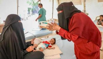 رضيعة يمنية تعاني من المرض - أرشيفية