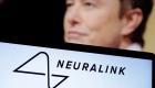 Elon Musk défend les tests de son implant cérébral Neuralink sur les animaux .. Comment?