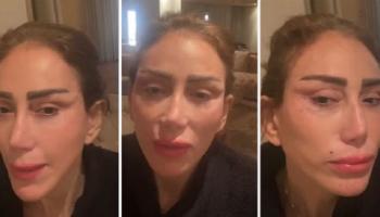 الإعلامية المصرية ريهام سعيد بعد جراحة التجميل