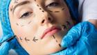 از عمل افزایش قد تا جراحی گوش؛ هزینه این عمل‌های عجیب چقدر است؟ 