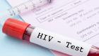 ما هو تحليل HIV فيروس نقص المناعة البشرية.. وما هي أنواعه؟
