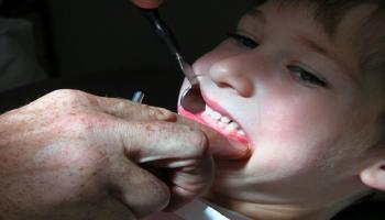 طبيب أسنان يفحص فم طفل- أرشيفية