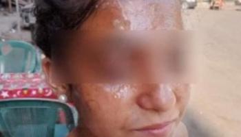 كارولين الطالبة المصرية المصابة