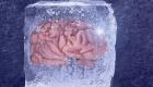 تقنية جديدة لتجميد أنسجة المخ دون ضرر