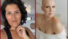Australie : diagnostic surprise de cancer à 36 ans, un message crucial de prévention 