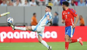 إصابة ليونيل ميسي قائد منتخب الأرجنتين