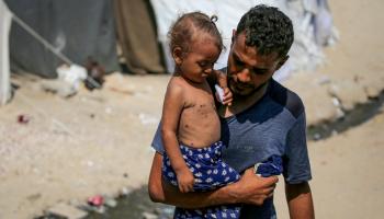 نازح فلسطيني يحمل ابنته بمخيم في دير البلح