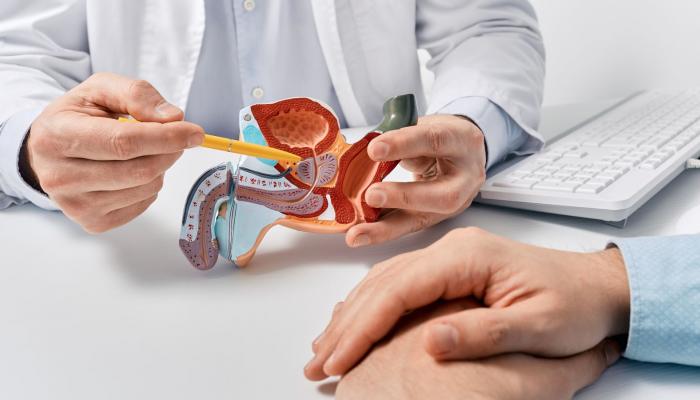 تجربة أميركية كبرى تختبر سلاحا ثلاثيا ضد سرطان البروستاتا المتقدم