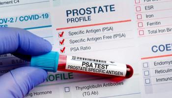 علماء يدعون لإجراء فحوص دم سنوية للرجال 