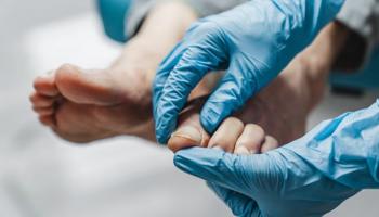 مرضى الأظافر المصابة المتصلبة قد يحصلون قريبا على علاج ثوري 